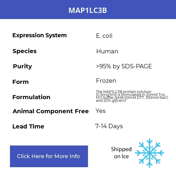 MAP1LC3B